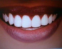 2 Zahnweiss-Stifte Whiter Teeth effektiv