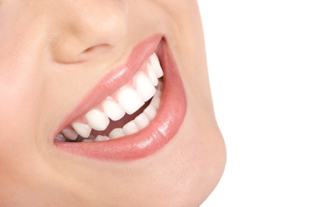 Komfort Bleaching 7 vorgefüllte Zahnschiene mittel - sensitiv