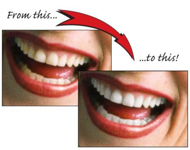 3 Zahnweiss-Stifte Whiter Teeth effektiv